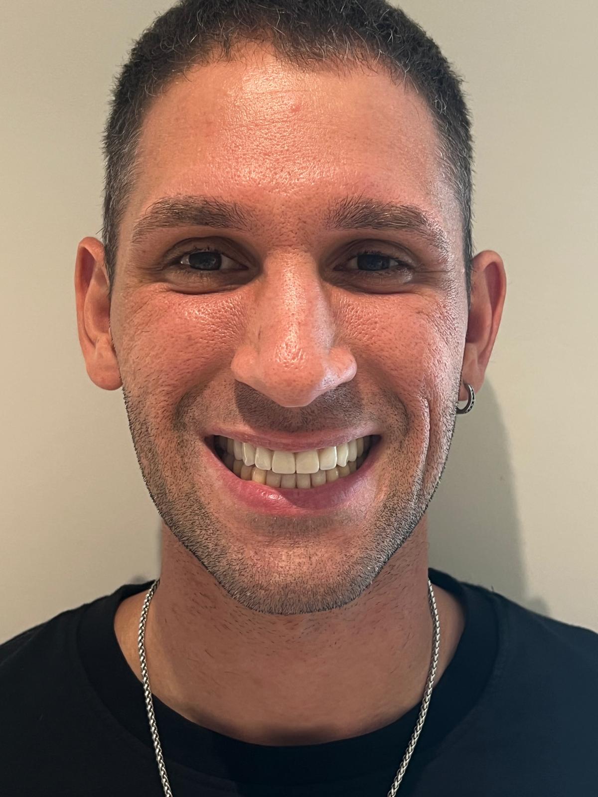 ECE Dental Patient Transformation